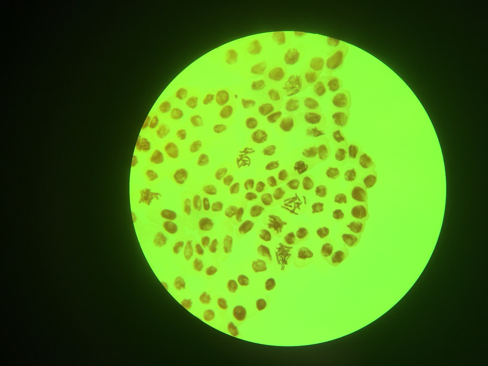 Microscope field of view showing root-tip cells with dark-stained nuclei and condensed chromosomes